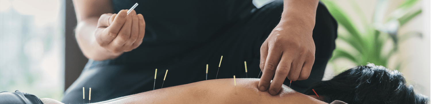 Chinese Herbs Acupuncture